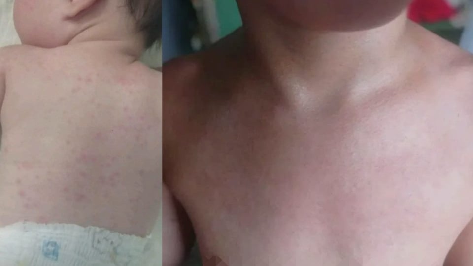 ¿Le dicen 'resiste' a una madre mientras su bebé se achicharra por los apagones?