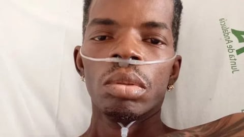 Cantante de Kola Loka en Estado Crítico en España: Familia Lanza Petición de Ayuda