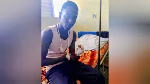 Joven pierde una mano tras intentar robar en una propiedad en Colón, Cuba