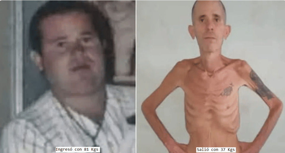 ¿Cáncer y cárcel en Cuba? Exiliados corren contra el tiempo por preso político agonizante