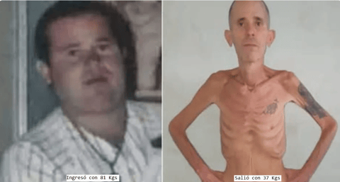 Exilio Cubano Busca Visa Humanitaria para Preso Político Enfermo de Cáncer