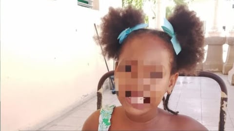 Madre en Camagüey busca desesperadamente una escuela especial para su hija con esclerosis tuberosa