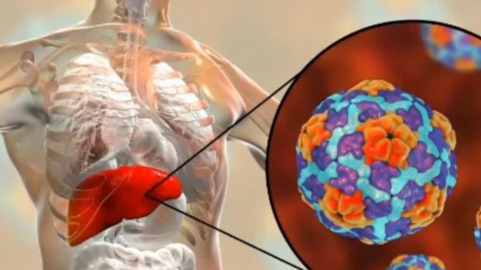 ¿Qué pasa, Pinar del Río? ¡Hay Hepatitis A y la gente anda con el alma en vilo!