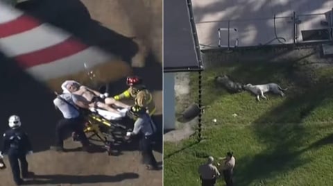 La policía de Miami abate perros para salvar a un hombre de ataque brutal