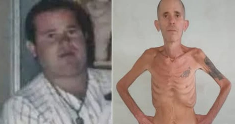 Preso Político Cubano Sobrevive a Años de Tortura y Sale con Cáncer Terminal
