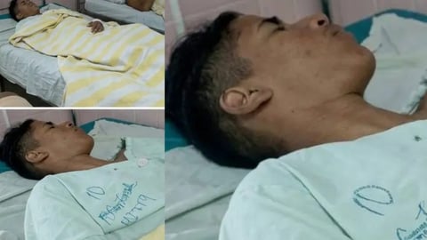 Adolescente Cubano Pierde Pierna Tras Presunta Agresión Policial en Santa Clara