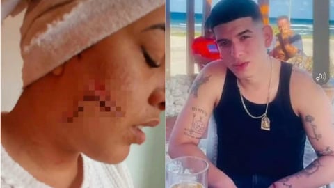 Madre denuncia brutal agresión y exige justicia en La Habana