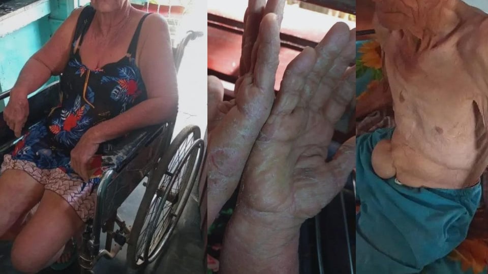 ¡Un Doctor en Apuros! Familia en Villa Clara Sufre por Faltas de Medicina y Pan