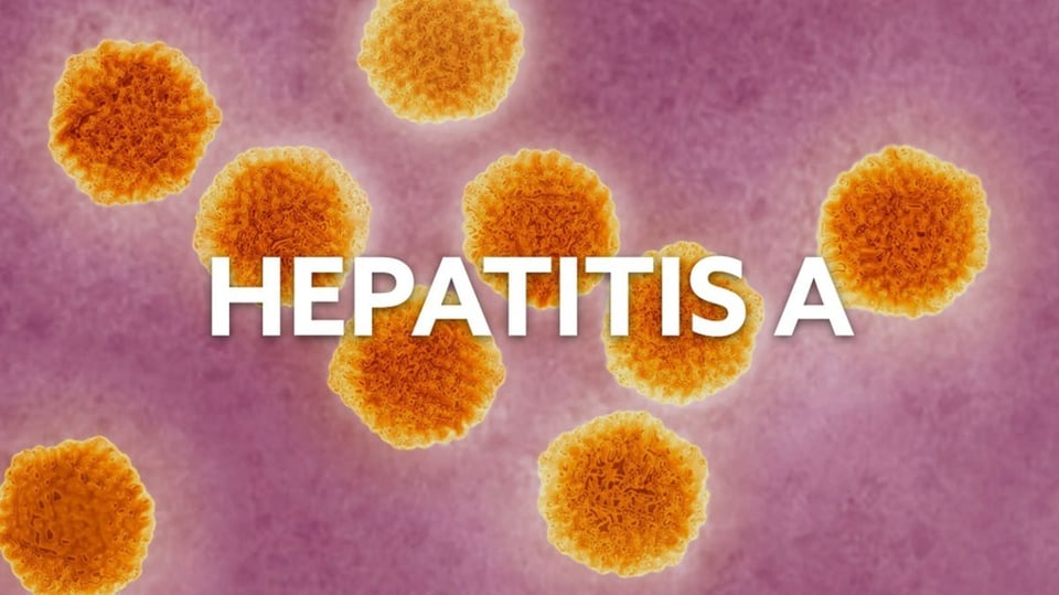 ¿Y tú supiste? Hepatitis se regó por Matanzas como bola de grasa y el agua sigue en $.