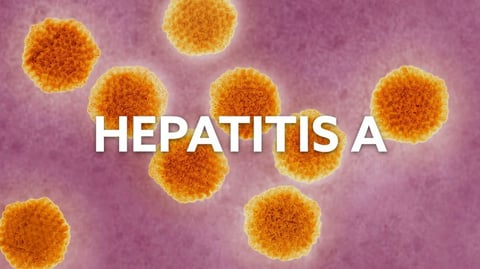 ¿Y tú supiste? Hepatitis se regó por Matanzas como bola de grasa y el agua sigue en $.