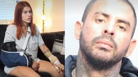 ¡34 Puñaladas y Viva! Madre Cubana Narra Milagro de Supervivencia a Ataque Brutal