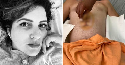 Joven Cubano Agredido Brutalmente Tras Enfrentar a Presunto Estafador