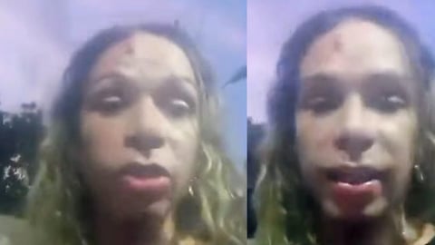 Travesti cubana denuncia falta de atención médica en hospital militar de La Habana