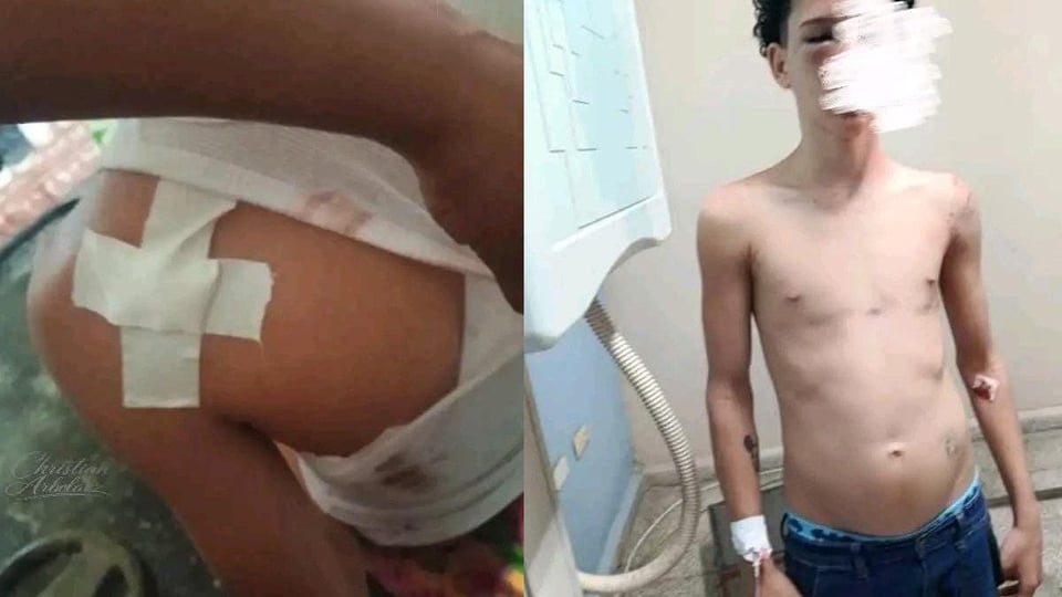 ¿Qué pasó en Cárdenas? Tibisan a un joven y la policía se hizo la loca