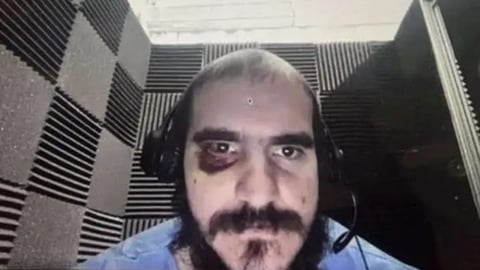 Migrante Cubano Denuncia Presunta Agresión en Centro de Detención de EE.UU.