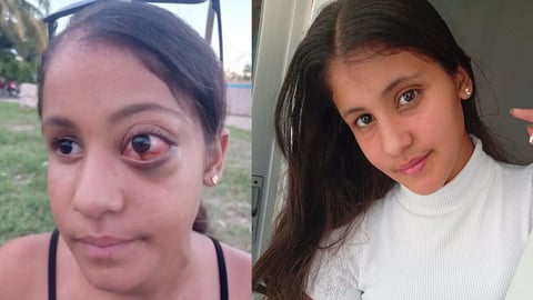 ¡Milagro en Madrid! Cubana Rocío vence grave enfermedad tras huir de la desidia