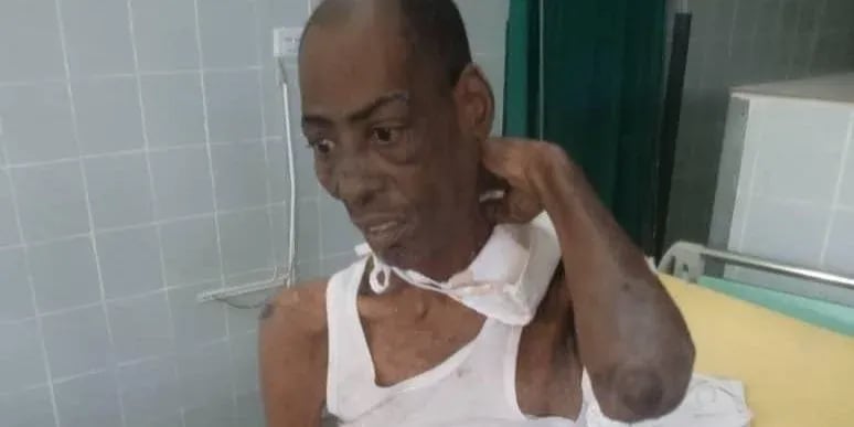 ¡Se Achicharró en Laizia! Preso se va pal Otro Barrio Tras Tralado Fallido