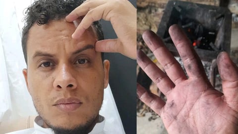 Médico Cubano Narra Agotamiento por La Vida Cotidiana y el Trabajo