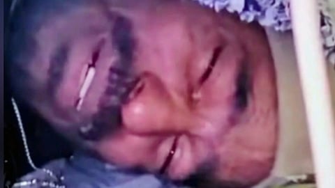 ¡SOS en Moscú! Joven cubano con leucemia pide ayuda para volver a casa