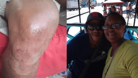 Asaltan y Lesionan a Trabajador en La Habana por Robarle Triciclo