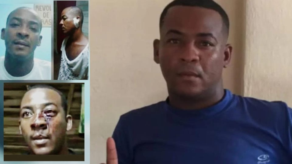 ¡Preso Político Cubano al Borde de la Muerte! 38 Días en Huelga de Hambre y Familia Pide Auxilio Urgente