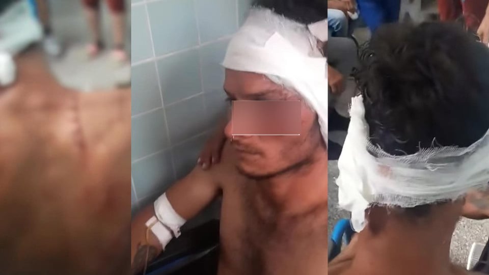 Joven Pierde Oreja en Brutal Ataque en Cienfuegos; Familia Sospecha Móvil Político