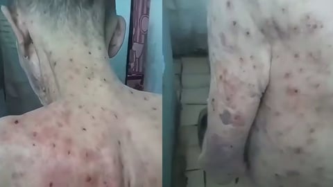 Alarming Conditions in Holguín Prison: Inmates Suffer from Plagues and Lack of Medicine