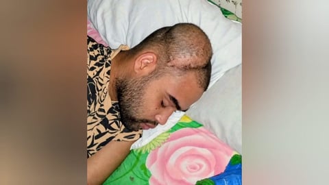 Joven espirituano necesita silla de ruedas y lámpara recargable para enfrentar tumor cerebral
