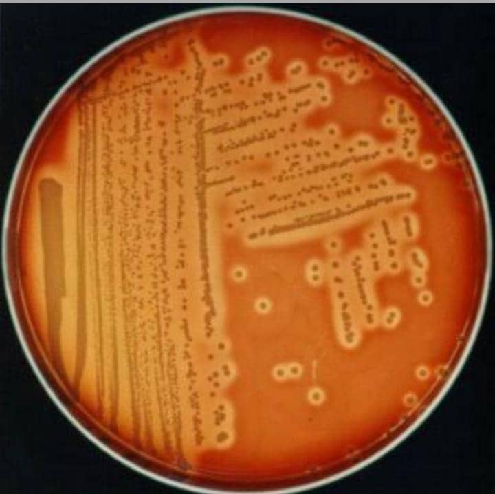 Estructura de bacterias grampositivas