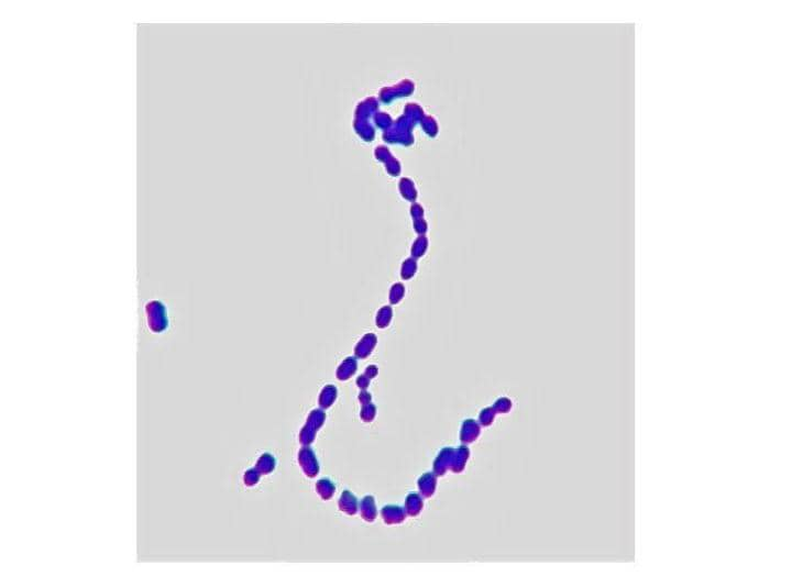 Streptococcus