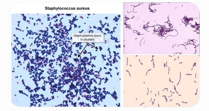 Bacterias grampositivas