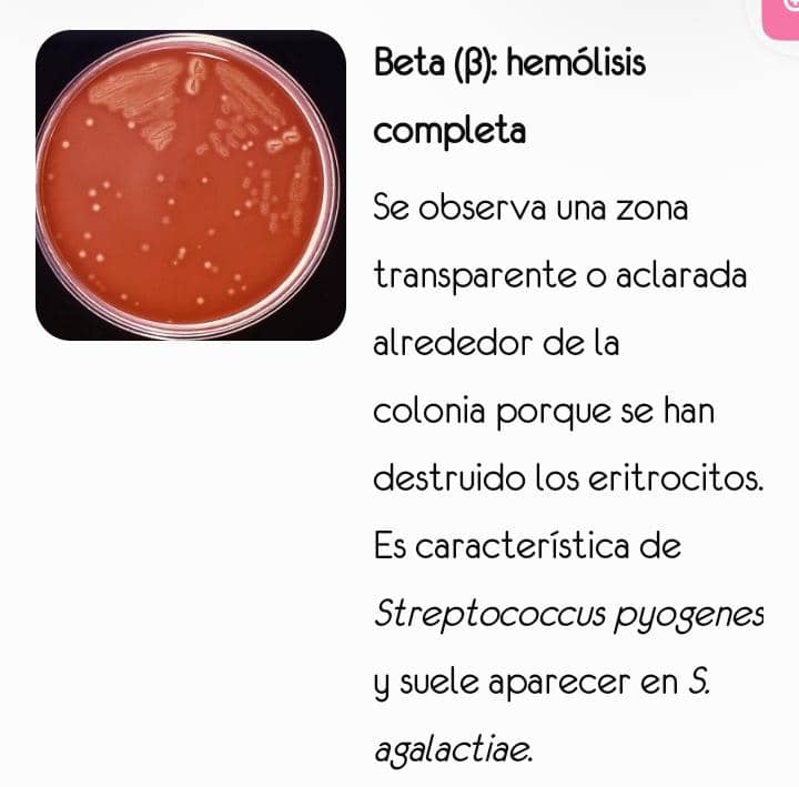 Hemólisis en agar sangre