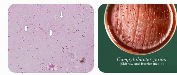 Campylobacter