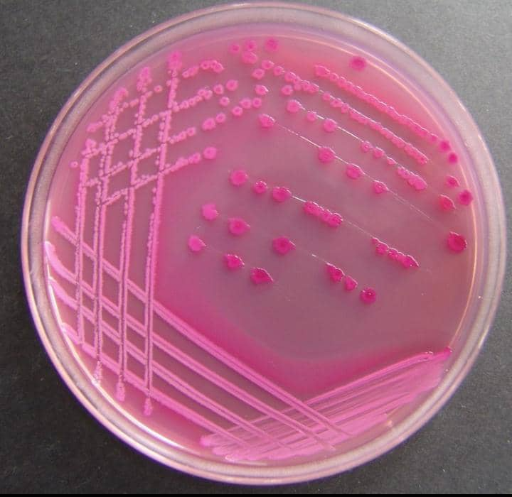 Escherichia coli