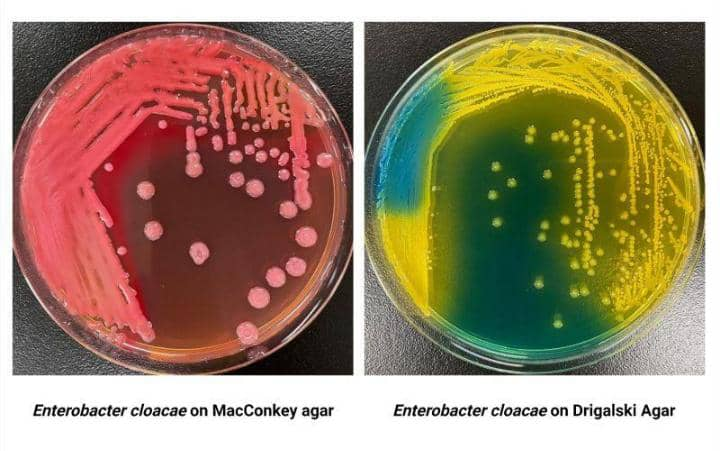 Enterobacter cloacae complex