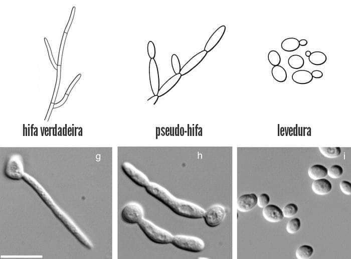 Hifa y pseudohifa