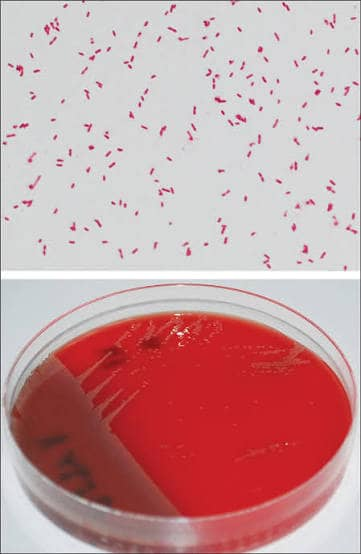 Stenotrophomonas maltophilia