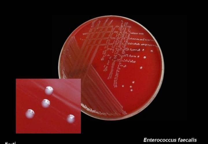 Enterococcus faecalis y E. faecium