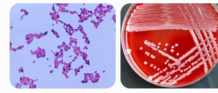 Acinetobacter baumannii y A. lwoffii