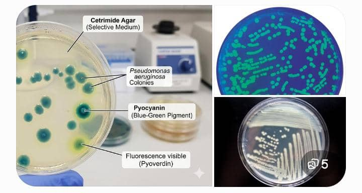 Pseudomonas aeruginosa