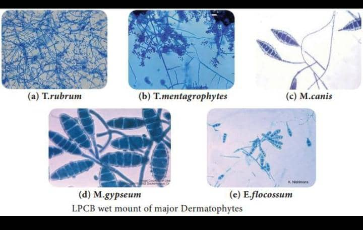 Laboratorio de dermatofitos