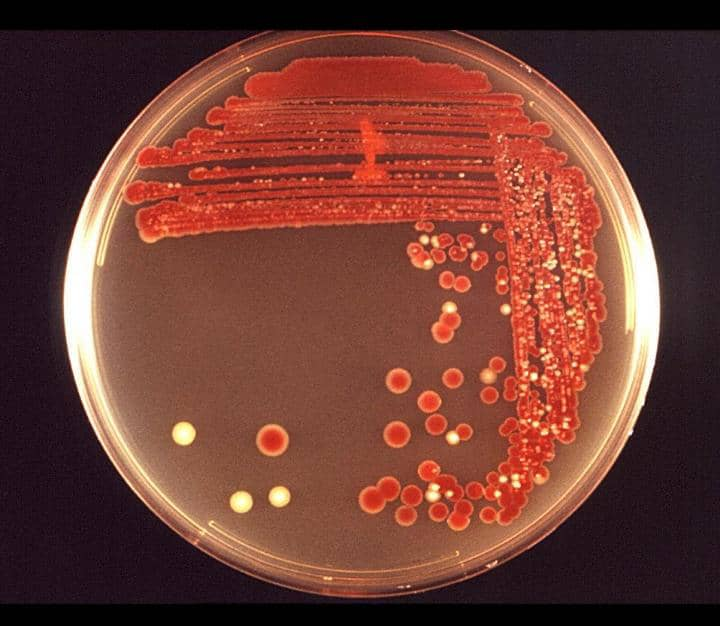 Serratia marcescens