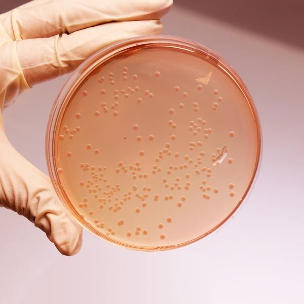 Proteus en MacConkey