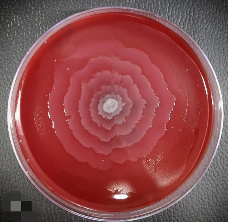 Proteus mirabilis (swarming)