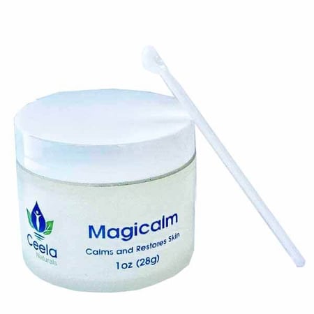 Magicalm Soothes Challenged Skin