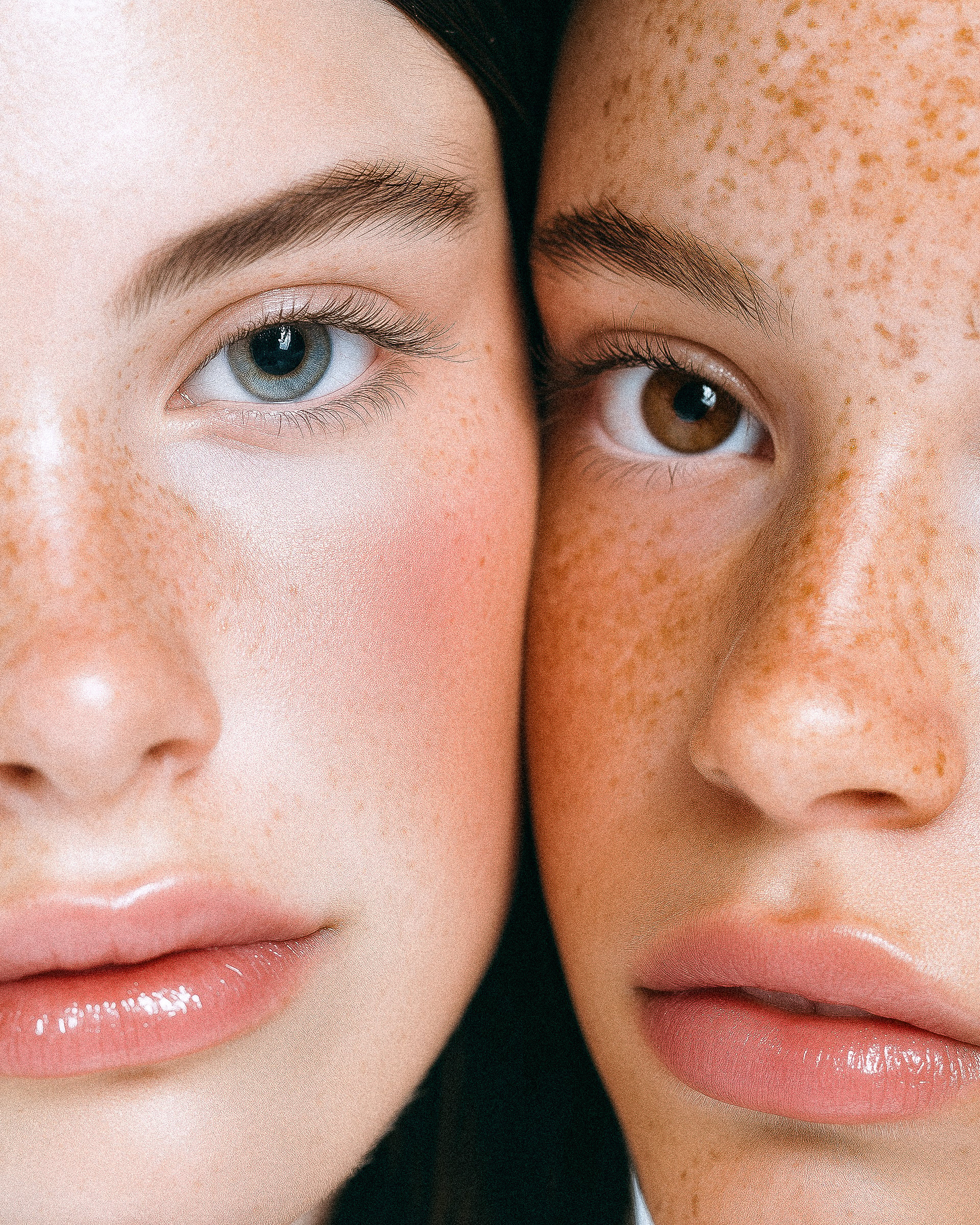 Freckled Faces Beauty Closeup