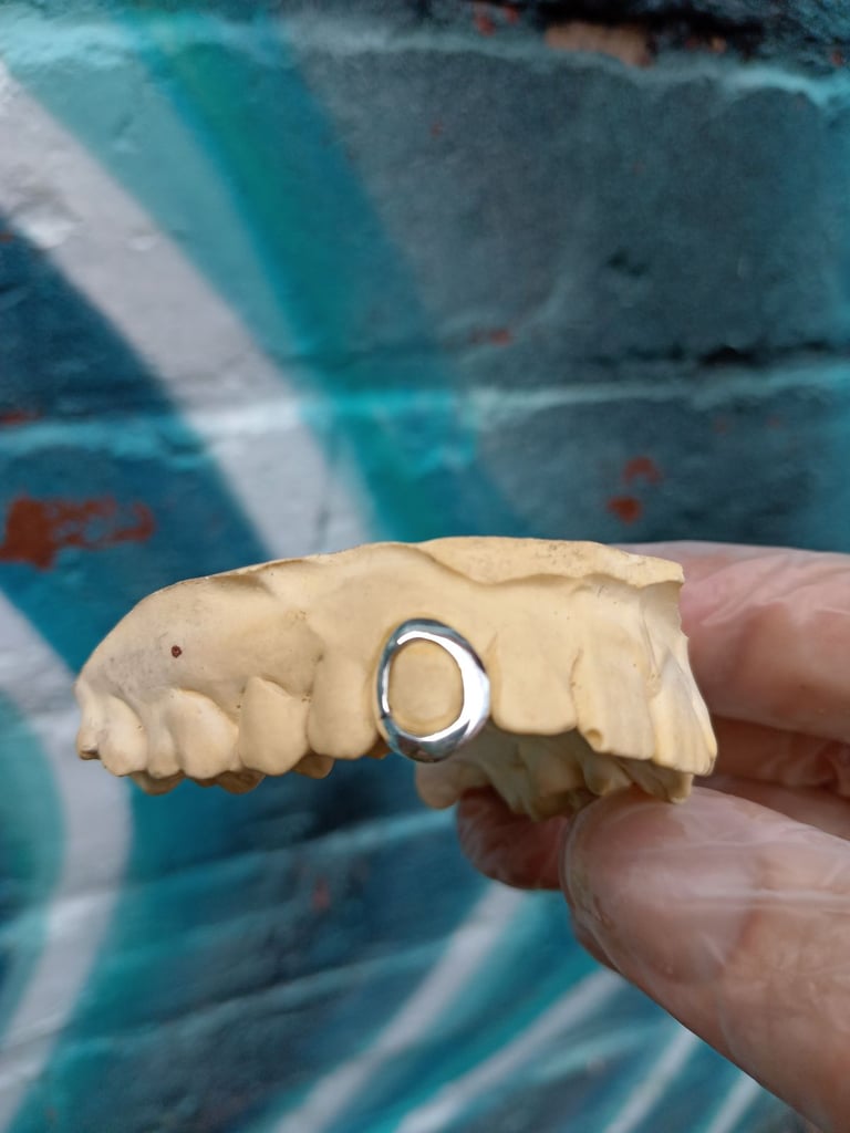 image for Custom made single cap window grillz 