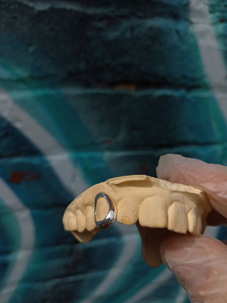 Custom made single cap window grillz 