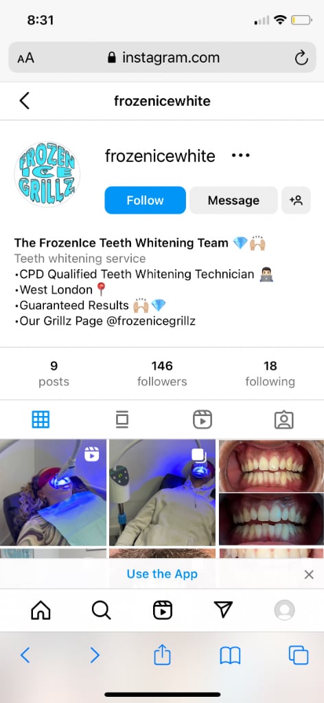 Teeth whitening service 