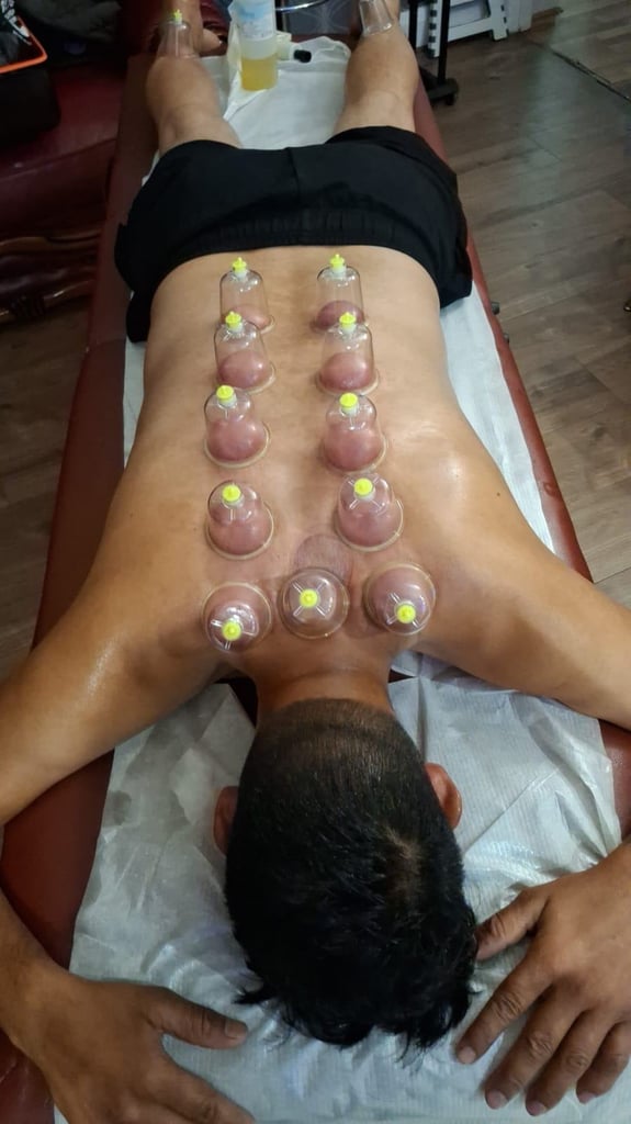 ertified Hijama Training Course in the UK
